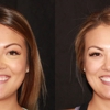 Intermountain Smiles gallery