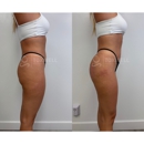 Toxwell Med Spa and Wellness