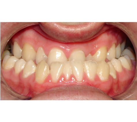 Active Orthodontics - Bundaberg South, QLD