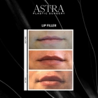 Astra Plastic Surgery - Alpharetta