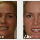 Mt. Pleasant Modern Dentistry - Cosmetic Dentistry