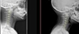 Peak Potential Family Chiropractic - Chiropractors & Chiropractic Services
