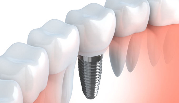 Gymea Dental