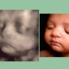 Chubby Cheeks 3D/4D Ultrasound Studio of Dallas gallery
