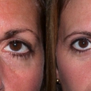 Hove Center for Facial Plastic Surgery - Day Spas