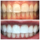 Organically White Teeth Whitening