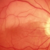 Retina Treatment Center gallery
