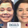 A Smile By Design gallery