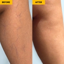 Metro Vein Centers | Staten Island