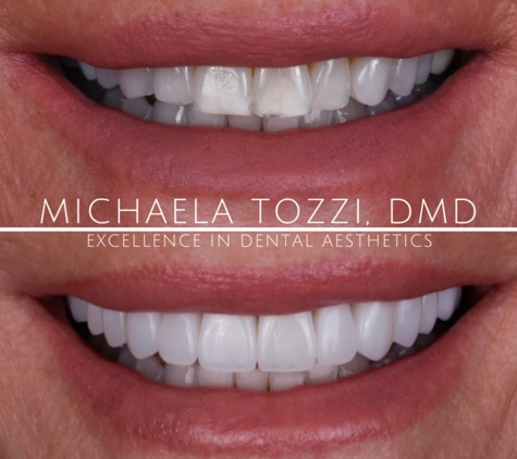 Dr. Michaela Tozzi, DMD: Cosmetic Dentistry & Dental Aesthetics - Henderson, NV