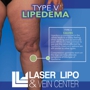 Laser Lipo and Vein Center