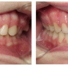 MI Smile Journey by Thomas Orthodontics - Saginaw
