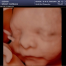 Heavenly 3D 4D Ultrasounds-Upland - Medical Imaging Services