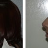 Newport Plastic and Reconstructive Surgery Associates: Dr. Hisham M. Seify gallery