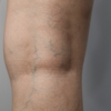 Loop Medical Center: Pain Management and Varicose Vein Doctor in Chicago gallery