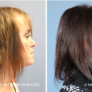 National Hair Loss - Hair Replacement