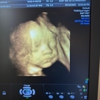 Baby Bee 3D Ultrasound + Photography Studio (Arlington) gallery