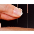 The Neighborhood Acupuncture Project