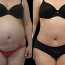 New York Group for Plastic Surgery