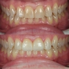 South Weber Dental gallery