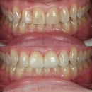 South Weber Dental - Dental Hygienists