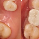 Summit Family Dental Care - Cosmetic Dentistry