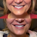 Nu Image Aesthetics & Wellness Institute Elgin - Day Spas
