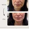 Permaskin Med Spa & Laser gallery