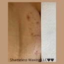 Shameless Waxing - Hair Removal