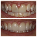 Smile Studio Dr Chad Ellis - Dentists