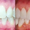 Bridgeline Dental gallery