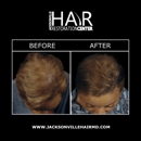 Jacksonville Hair Restoration Center - Hair Replacement