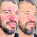 Injections and Co. Sarasota Medical Spa