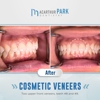 MacArthur Park Dentistry Family Cosmetic Veneers Emergency Implants Invisalign gallery