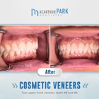 MacArthur Park Dentistry Family Cosmetic Veneers Emergency Implants Invisalign