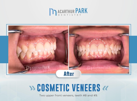 MacArthur Park Dentistry Family Cosmetic Veneers Emergency Implants Invisalign - Irving, TX