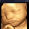 Heavenly 3d 4d Ultrasounds gallery