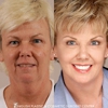 English Plastic and Cosmetic Surgery Center gallery