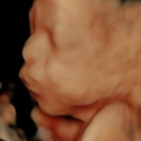 A New Conception 4D Ultrasound Studio