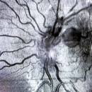 The Eye Site - Medical Centers
