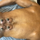 Acupuncture Pain and Stress Center - Acupuncture