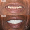 Brilliant Smiles Lakeland Dentist gallery