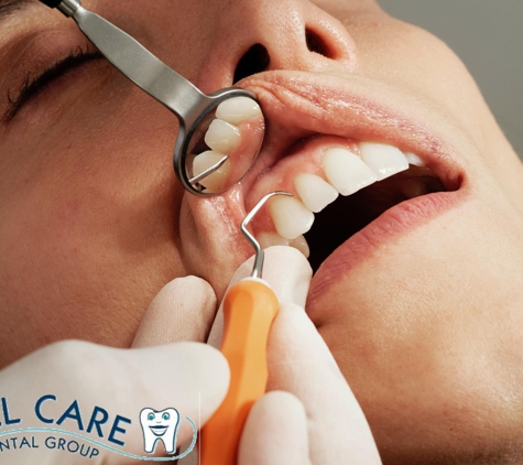 All Care Dental Group - Rancho Cucamonga, CA