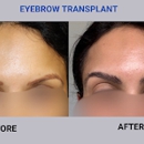 BKS Hair Restoration - Surgery Centers