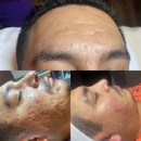 Pro Health Wellness Center & Spa - Massage Services