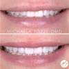 Dr. Michaela Tozzi, DMD: Cosmetic Dentistry & Dental Aesthetics gallery