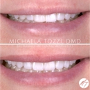 Dr. Michaela Tozzi, DMD: Cosmetic Dentistry & Dental Aesthetics - Cosmetic Dentistry