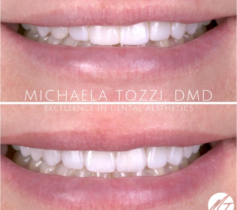 Dr. Michaela Tozzi, DMD: Cosmetic Dentistry & Dental Aesthetics - Henderson, NV