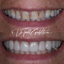The Smile Aesthetic - Implant Dentistry