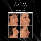 Astra Plastic Surgery - Atlanta